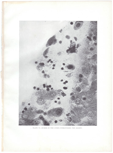 SECTION THROUGH THE TESTIS...